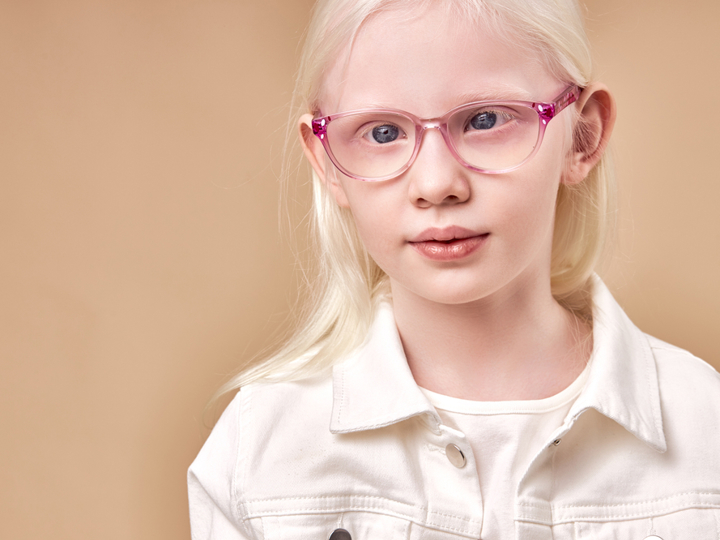 Albinism Rariity Albinism eyesight