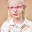 Girl with albinism wearing pink glasses.